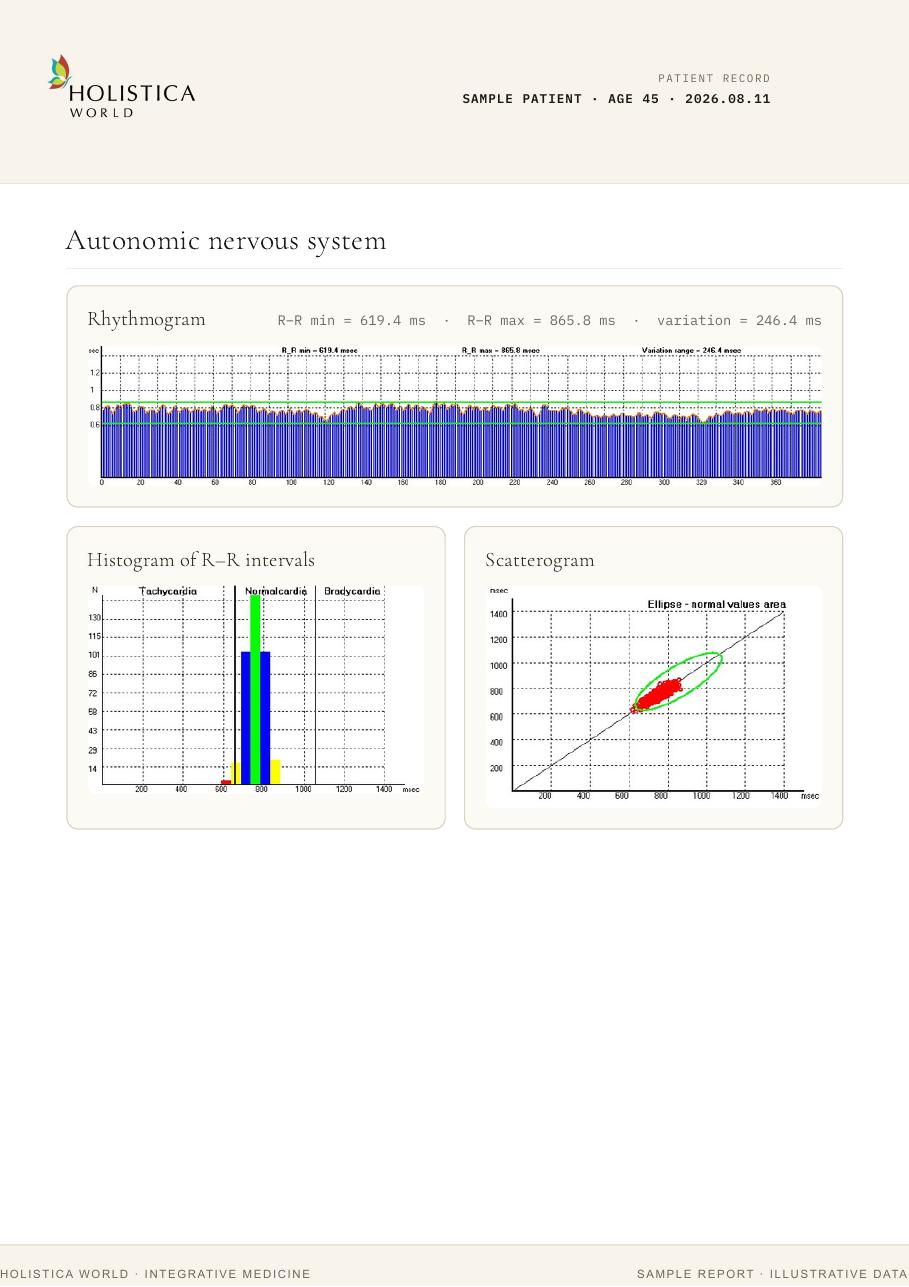 Signal quality page from the NPS sample report