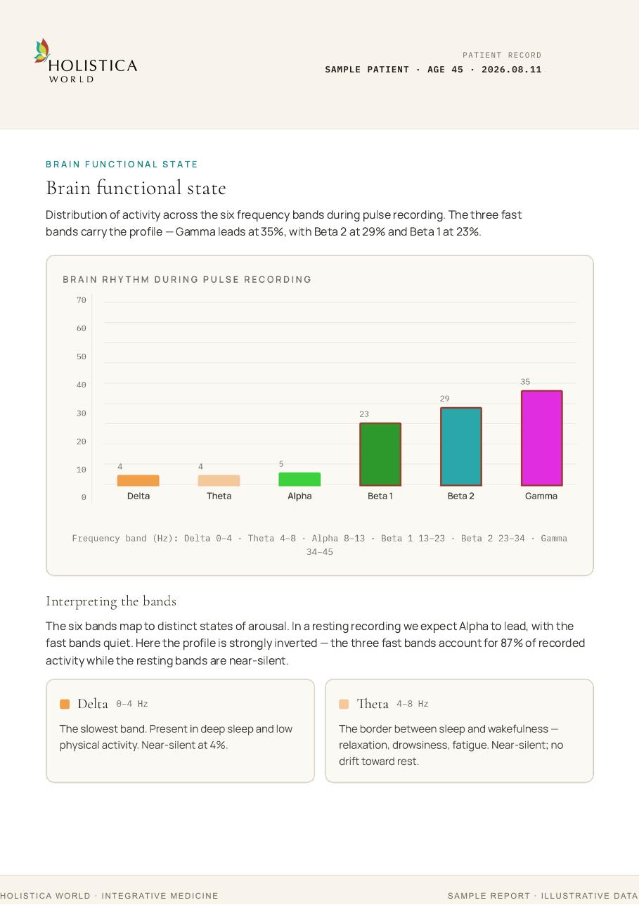 Brain rhythm page from the NPS sample report